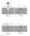 Fig. 06 - System of components or implements for easily and precisely installing a dental implant, and a method of installing the dental implant