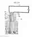 Fig. 02 - Endodontic file system for cleaning and shaping a root canal