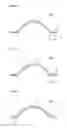 Fig. 06 - Customized alveolar bone tissue and method of forming the same