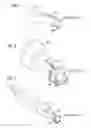 Fig. 04 - Apparatus and method for recording digital images and presenting 3D models of a body lumen