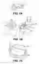 Fig. 02 - Method and system for fabricating a dental coping, and a coping fabricated thereby