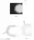Fig. 06 - Scanning dental impressions