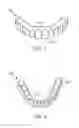 Fig. 02 - Dental devices and systems and methods for making the same