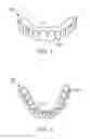 Fig. 02 - DENTAL DEVICES AND SYSTEMS AND METHODS FOR MAKING THE SAME