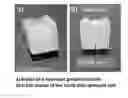 Fig. 01 - DENTAL PROSTHESIS WITH A MULTIPART DESIGN, AND METHOD AND DEVICE FOR PRODUCING SAME