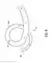 Fig. 09 - Ureteral stent with anti-migration features