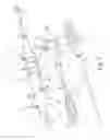 Fig. 02 - Preloaded wire for endoluminal device