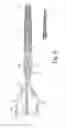 Fig. 07 - Preloaded wire for endoluminal device