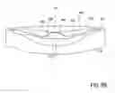 Fig. 07 - Accommodating intraocular lenses