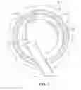 Fig. 03 - Capsular tension ring inserter and method