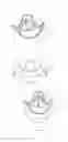 Fig. 05 - Heart valve bioprosthesis and manufacturing method thereof