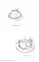 Fig. 06 - Heart valve bioprosthesis and manufacturing method thereof