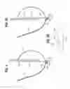 Fig. 04 - Prosthetic heart valve having leaflet inflow below frame