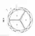 Fig. 05 - Prosthetic heart valve having leaflet inflow below frame