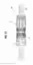 Fig. 08 - Prosthetic heart valve having leaflet inflow below frame