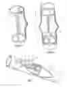 Fig. 03 - Implantable vein frame