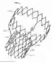 Fig. 01 - Stent features for collapsible prosthetic heart valves