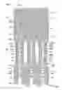 Fig. 04 - Stent features for collapsible prosthetic heart valves