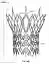 Fig. 13 - Stent features for collapsible prosthetic heart valves