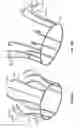 Fig. 32 - Stent features for collapsible prosthetic heart valves
