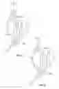Fig. 33 - Stent features for collapsible prosthetic heart valves