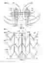 Fig. 34 - Stent features for collapsible prosthetic heart valves