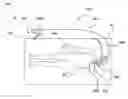 Fig. 01 - STABILIZATION AND ADVANCEMENT SYSTEM FOR DIRECT AORTIC TRANSCATHETER AORTIC VALVE IMPLANTATION