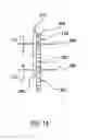 Fig. 13 - STABILIZATION AND ADVANCEMENT SYSTEM FOR DIRECT AORTIC TRANSCATHETER AORTIC VALVE IMPLANTATION