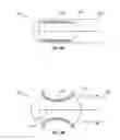 Fig. 09 - Cardiac implant delivery system