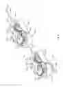 Fig. 13 - Cardiac implant delivery system