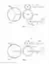 Fig. 16 - Cardiac implant delivery system