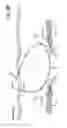 Fig. 10 - Fixation devices, systems and methods for heart valve leaf repair
