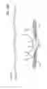Fig. 17 - Fixation devices, systems and methods for heart valve leaf repair