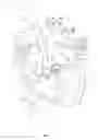 Fig. 02 - Opposing disk device for grasping cardiac valve tissue