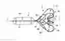 Fig. 01 - IMPLANTABLE DEVICE FOR IMPROVING OR TREATING A HEART VALVE INSUFFICIENCY