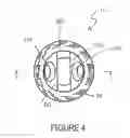 Fig. 05 - Bone implant