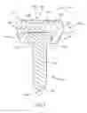 Fig. 06 - Radial head implant