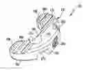 Fig. 01 - Implant for bone fixation