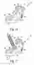 Fig. 10 - Implant for bone fixation