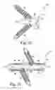 Fig. 12 - Implant for bone fixation