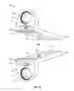 Fig. 08 - Spinal implants for rotationally adjusting vertebrae