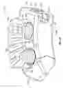 Fig. 63 - Expandable interbody and intravertebral body devices