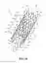 Fig. 02 - Stent