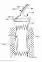 Fig. 01 - Methods of repositioning a transcatheter heart valve after full deployment