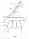 Fig. 06 - Methods of repositioning a transcatheter heart valve after full deployment