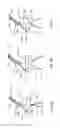 Fig. 07 - Methods of repositioning a transcatheter heart valve after full deployment