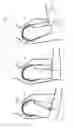 Fig. 06 - Shoulder brace for simple-pendulum motion