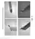Fig. 06 - Intraocular device for dual incisions