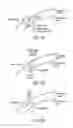 Fig. 22 - Laser eye surgery system