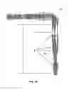 Fig. 35 - Laser eye surgery system